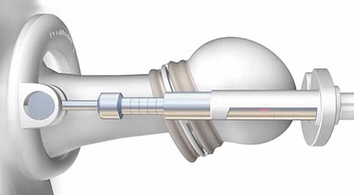 Diagram naprave